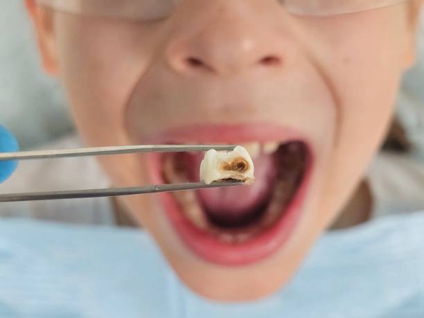  Forest Oaks, NC Emergency Dentist Pros